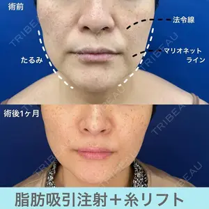 湘南美容クリニック 福岡院の症例