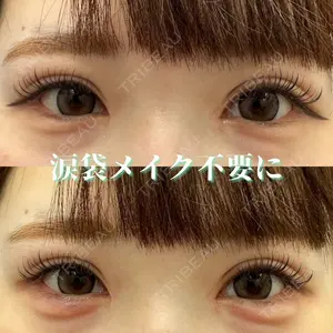 湘南美容クリニック 博多院 西川 菜穂子医師の症例