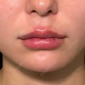 PRISM Beauty Clinic 新宿院 畑山 知輝医師の症例