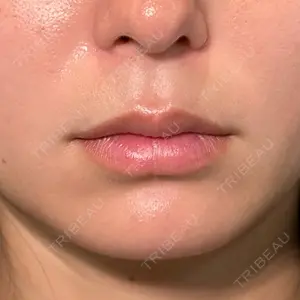 PRISM Beauty Clinic 新宿院 畑山 知輝医師の症例