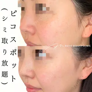 Mavie Beauty Clinic （マヴィービューティークリニック）の症例