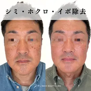 Mavie Beauty Clinic （マヴィービューティークリニック）の症例