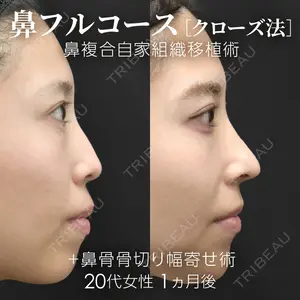 ジョウクリニック 銀座院 重本　譲医師の症例