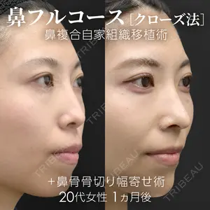 ジョウクリニック 銀座院 重本　譲医師の症例
