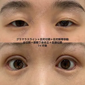 エターナル美容クリニック 久門田 詳医師の症例