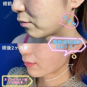 湘南美容クリニック 福岡院の症例