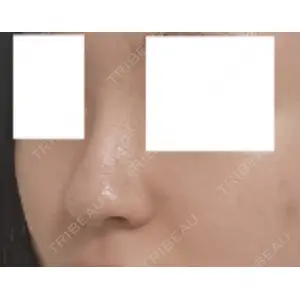 LUHO（ルホ）美容外科 キム・ジュンヨン医師の症例