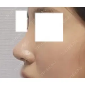LUHO（ルホ）美容外科 キム・ジュンヨン医師の症例
