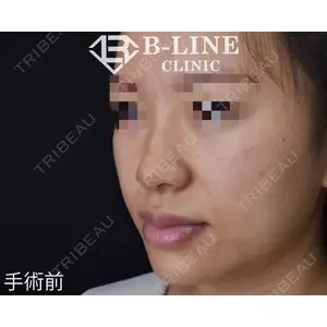 B-LINE CLINIC 池袋院 小池 康弘医師の症例