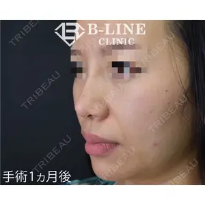B-LINE CLINIC 池袋院 小池 康弘医師の症例