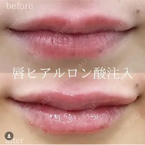 湘南美容クリニック 銀座院の症例