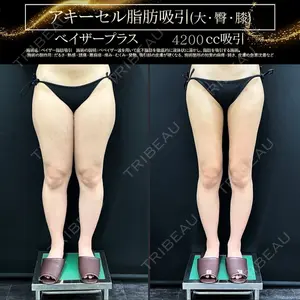 湘南美容クリニック 福岡院の症例
