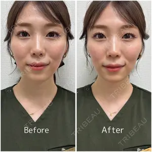 ギャラリークリニック 銀座の症例