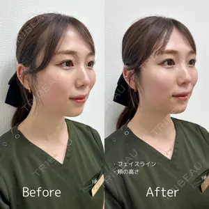 ギャラリークリニック 銀座の症例