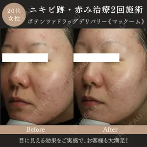 MIO CLINIC 梅田院の症例