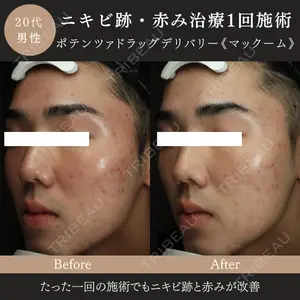 MIO CLINIC 梅田院の症例