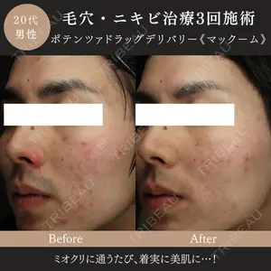 MIO CLINIC 梅田院の症例