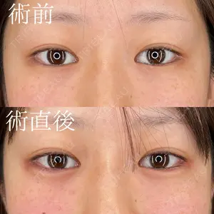 HAAB×DREAM BEAUTY CLINIC 大阪梅田院 柏木 太雅医師の症例