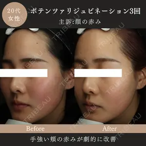 MIO CLINIC 梅田院の症例