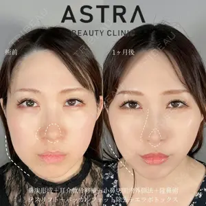 ASTRA BEAUTY CLINIC 塩満 惠子医師の症例