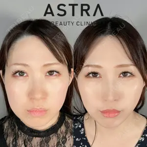ASTRA BEAUTY CLINIC 塩満 惠子医師の症例