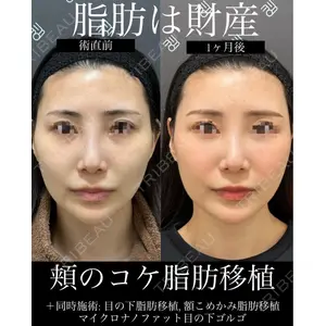 EMMO FACE CLINIC 大宮院 廣松 直樹医師の症例