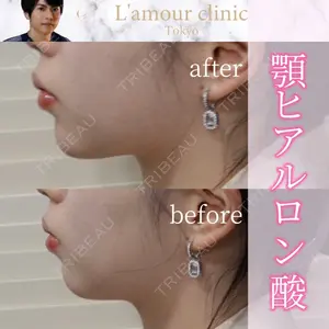 L‘amour clinic Tokyo【ラムールクリニック東京】の症例