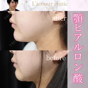 L‘amour clinic Tokyo【ラムールクリニック東京】の症例