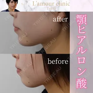 L‘amour clinic Tokyo【ラムールクリニック東京】の症例