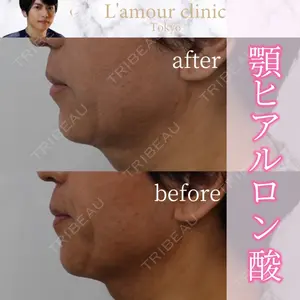 L‘amour clinic Tokyo【ラムールクリニック東京】の症例