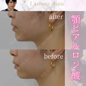 L‘amour clinic Tokyo【ラムールクリニック東京】の症例