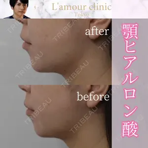 L‘amour clinic Tokyo【ラムールクリニック東京】の症例