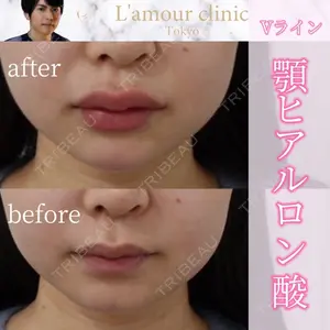 L‘amour clinic Tokyo【ラムールクリニック東京】の症例