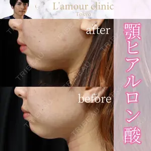 L‘amour clinic Tokyo【ラムールクリニック東京】の症例