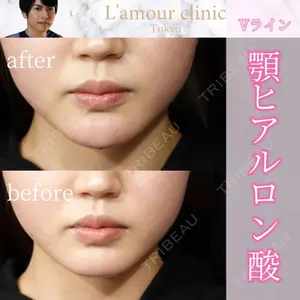 L‘amour clinic Tokyo【ラムールクリニック東京】の症例