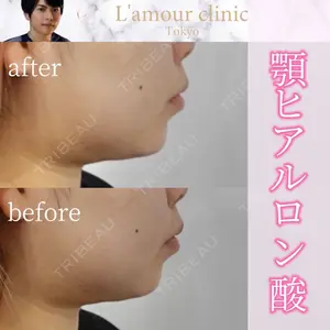 L‘amour clinic Tokyo【ラムールクリニック東京】の症例