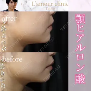 L‘amour clinic Tokyo【ラムールクリニック東京】の症例