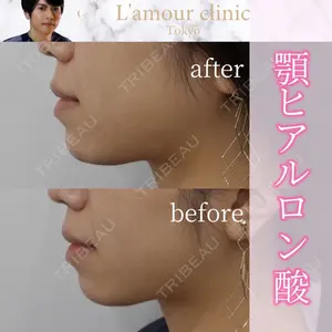 L‘amour clinic Tokyo【ラムールクリニック東京】の症例