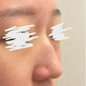 LUHO（ルホ）美容外科 キム・ジュンヨン医師の症例