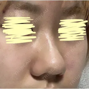 LUHO（ルホ）美容外科 キム・ジュンヨン医師の症例