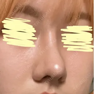 LUHO（ルホ）美容外科 キム・ジュンヨン医師の症例