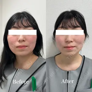 ギャラリークリニック 銀座 西川医師の症例