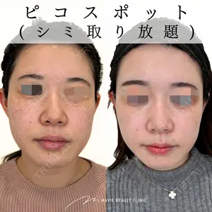 Mavie Beauty Clinic （マヴィービューティークリニック）の症例