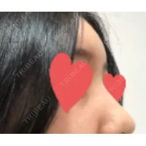 LUHO（ルホ）美容外科 キム・ジュンヨン医師の症例