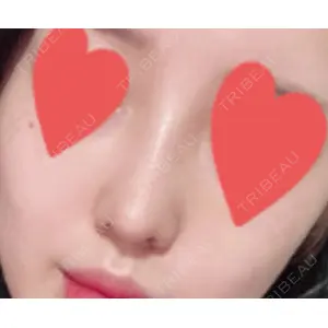 LUHO（ルホ）美容外科 キム・ジュンヨン医師の症例