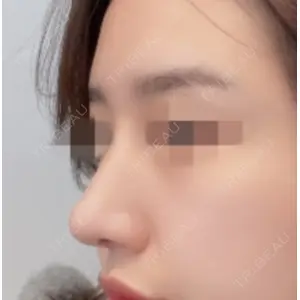 LUHO（ルホ）美容外科 キム・ジュンヨン医師の症例