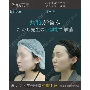 湘南美容クリニック 名古屋院 山本 高士医師の症例