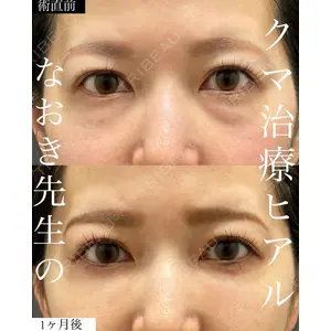 EMMO FACE CLINIC 大宮院 廣松 直樹医師の症例