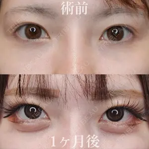 Tokyo Tensei Clinic 新宿院の症例