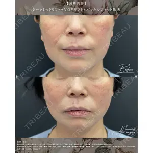 湘南美容クリニック 銀座院の症例